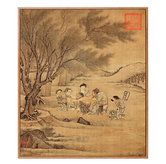 YUANWELLNESS: Custom Moxibustion Painting, Ancient Artwork Illustrating the Performance of Moxibustion, Artwork of TCM, for Clinic Wall Art - YUAN WELLNESS 